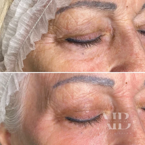 Radiant Glo glow facial before and after at Allure Infinite Beauty in Mesa, AZ