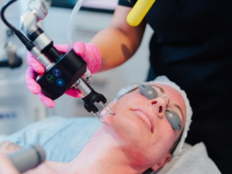 CoolPeel vs Microneedling: Which Skin Treatment Does What?