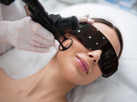 CO2 Laser Resurfacing in Mesa, AZ: The Complete Guide