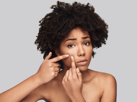Best Facial Treatments for Acne-Prone Skin